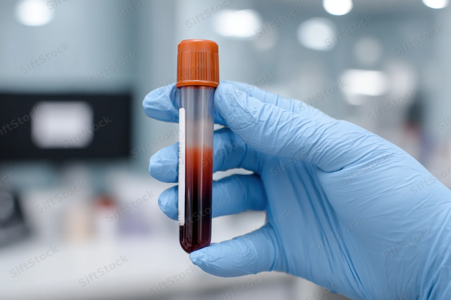Gloved hand holding a blood sample tube in a laboratory setting