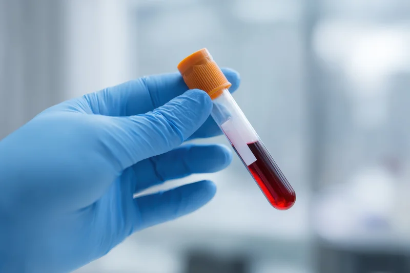 Gloved hand holding a blood sample tube in a laboratory setting