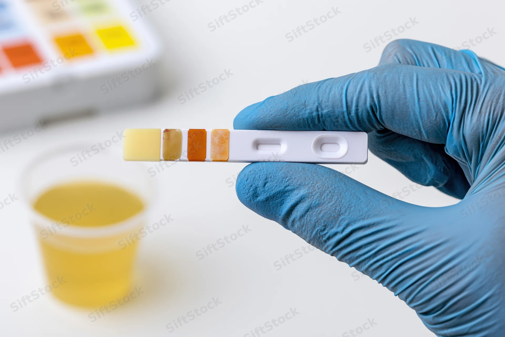 Gloved hand holding urine dipstick test strip over sample cup in lab setting