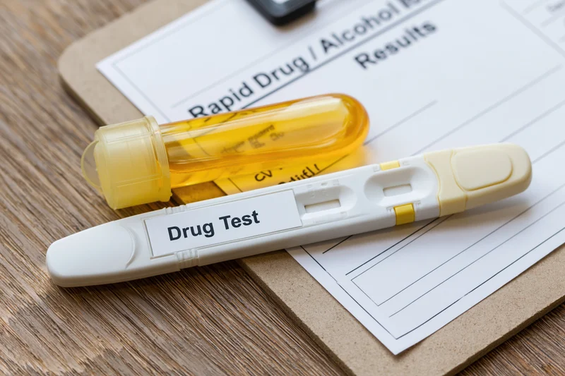Rapid drug test cassette and urine sample on a results form on a clipboard