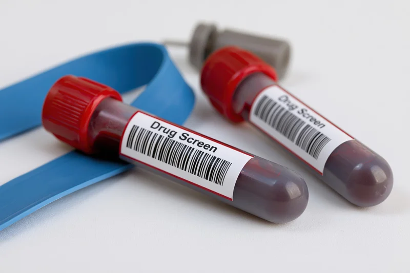 Two blood collection vials labeled drug screen with red caps and barcode labels on white surface