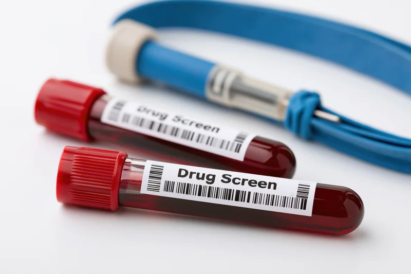 Two blood vials labeled drug screen with a tourniquet and syringe on white background