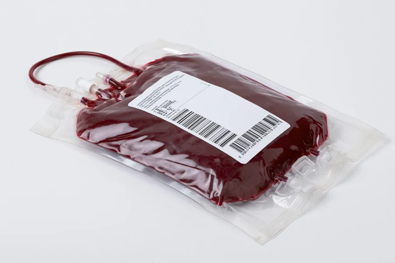Filled medical blood donation bag with label and tubing lying flat on white surface