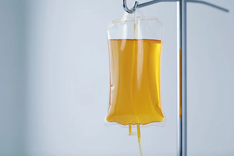 Amber-yellow iv fluid bag hanging from chrome medical stand