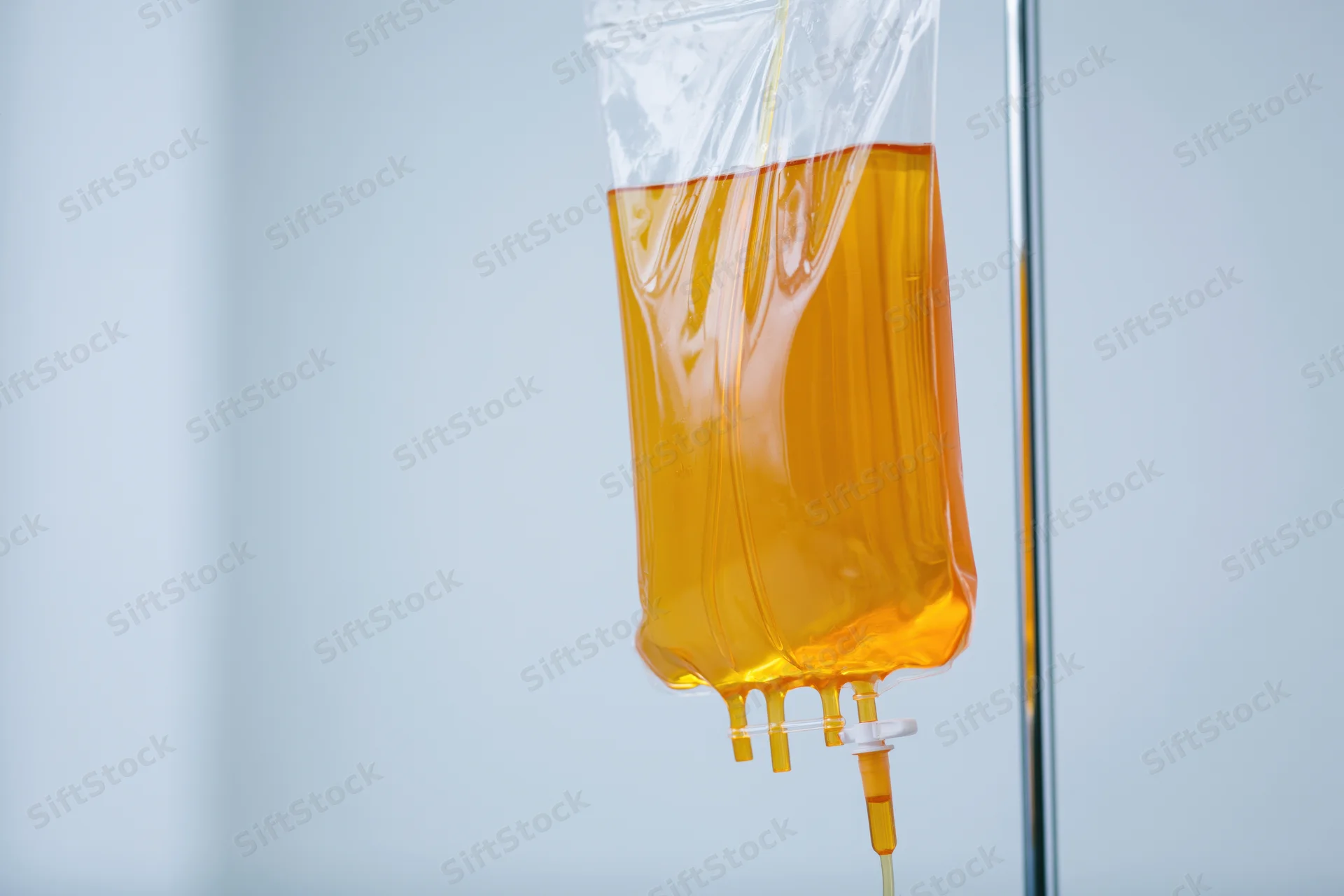 Amber-yellow iv fluid bag hanging from chrome medical stand in clinical setting