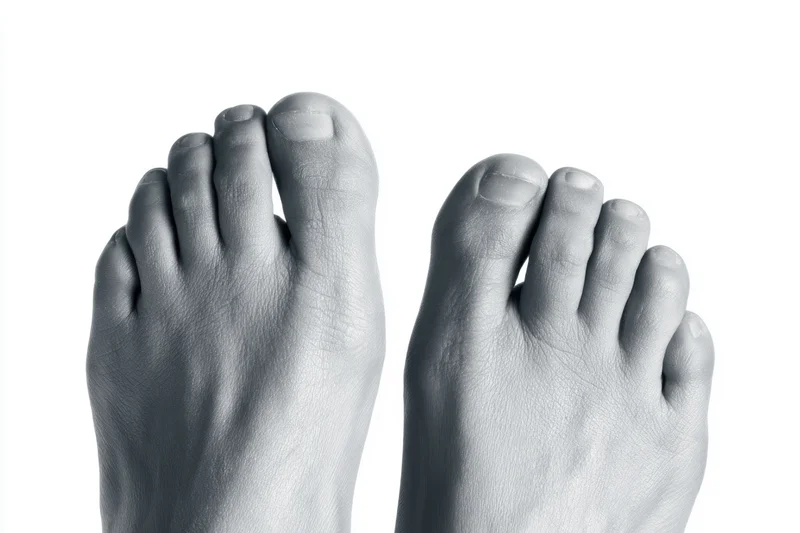 Two bare human feet shown in closeup against a white background in grayscale