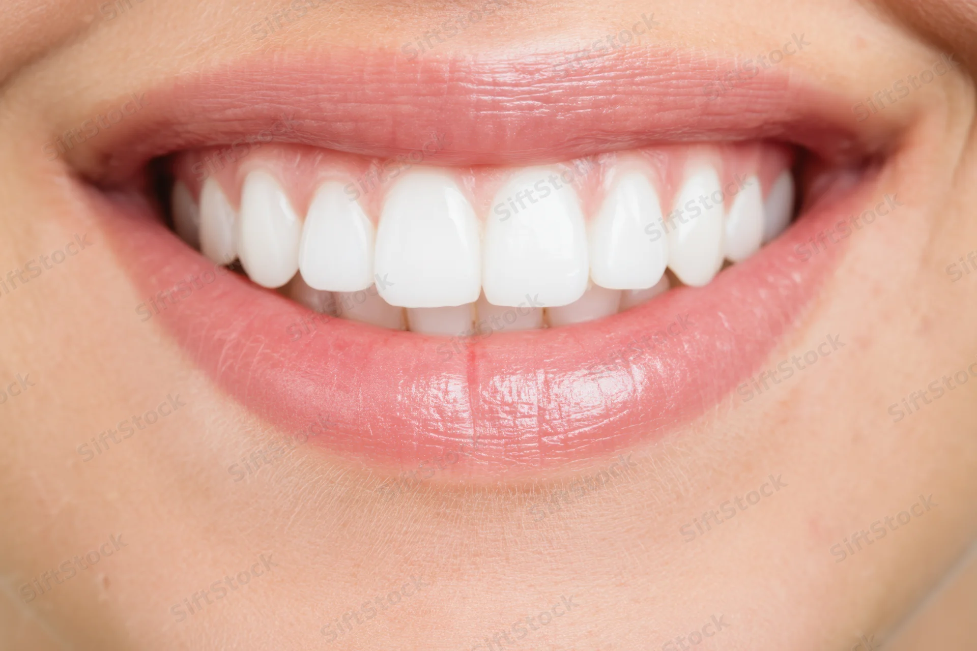 Close-up of a woman's smiling mouth showing bright white teeth and pink lips