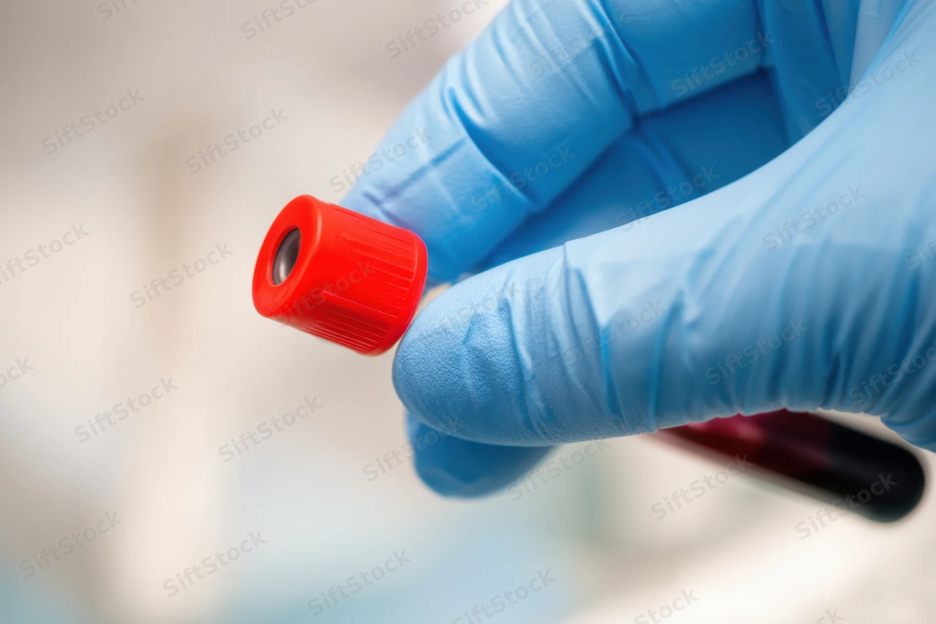 Hand in blue latex glove holding a red-capped blood collection tube with visible sample inside