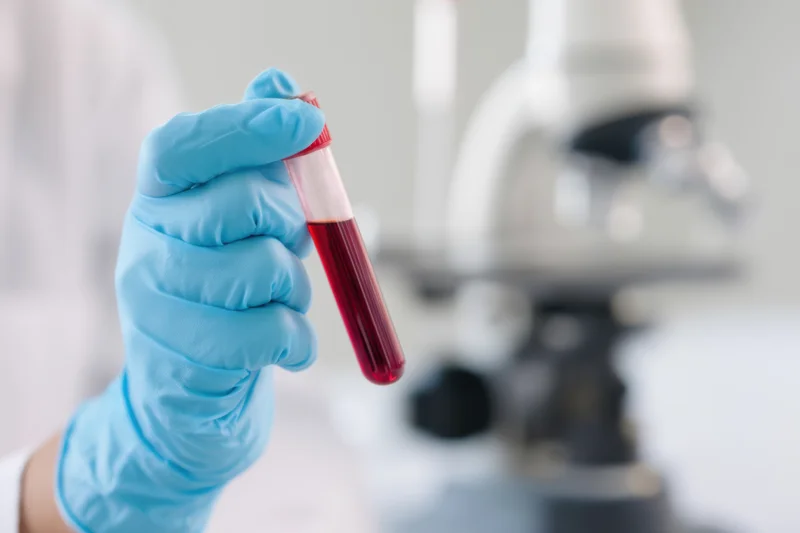 Gloved hand holding a blood-filled test tube in a laboratory setting with microscope in background