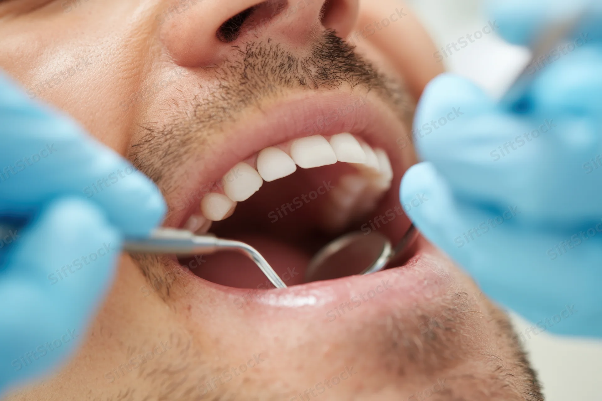 Close-up of a male patient's open mouth during dental examination with dental mirror and probe in use