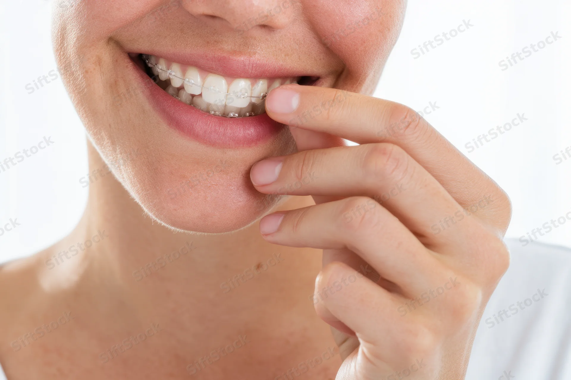 Woman smiling with braces, hand touching lower teeth, close-up view