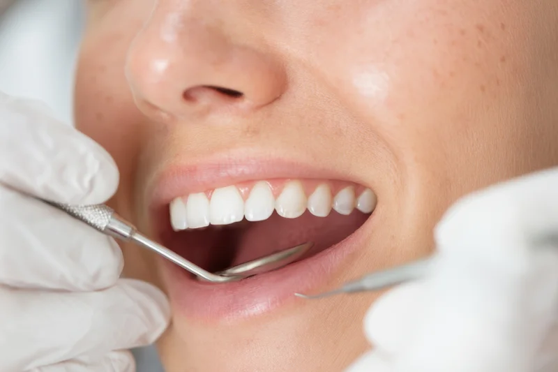Woman undergoing dental examination with tools in her open mouth at clinic