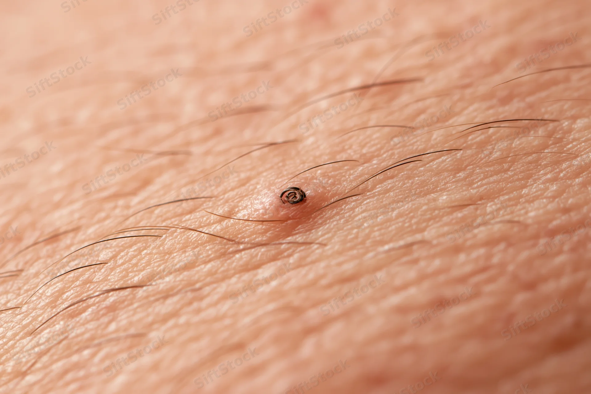 Extreme closeup of human skin surface showing hair follicle and pores