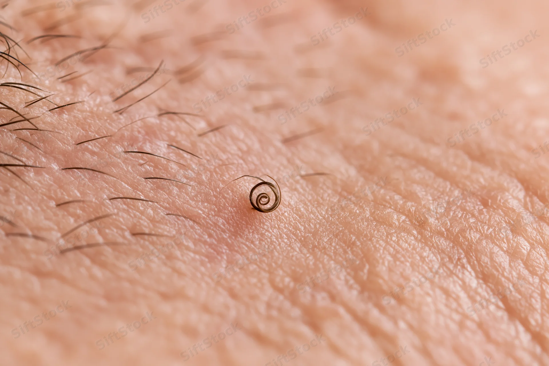 Extreme close-up of human skin surface showing fine hairs and a coiled hair follicle