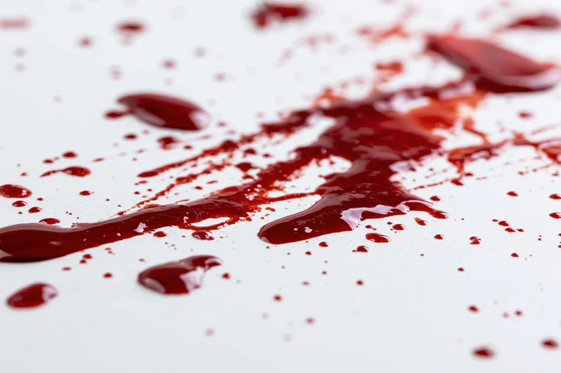 Blood splatter and drip marks on a white surface