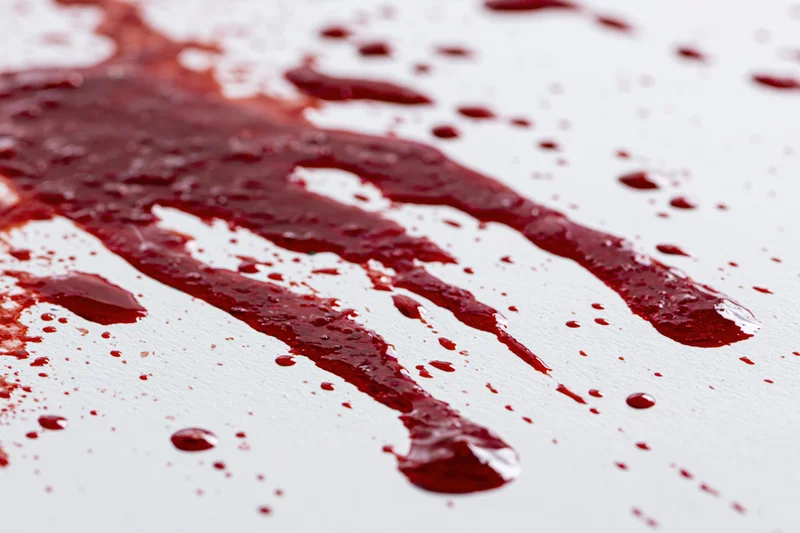 Blood splatter and drip marks on a white surface