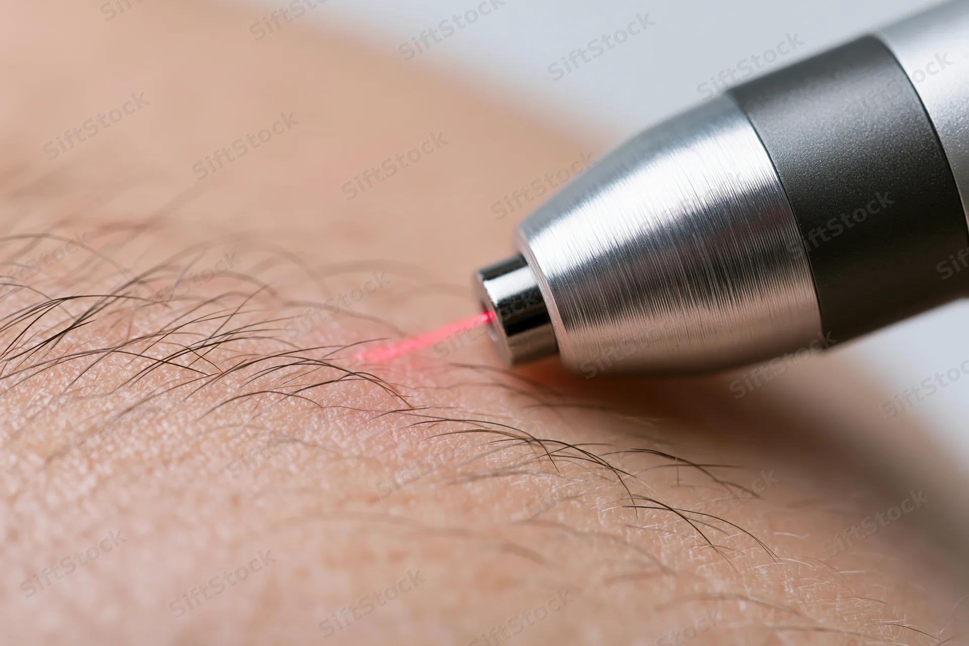 Handheld laser device emitting red beam on skin for hair removal