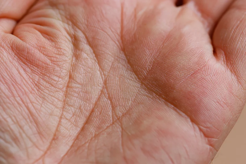 Close-up of an open human palm showing detailed skin texture and wrinkles