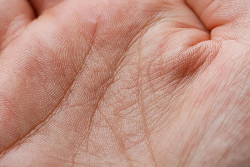 Close-up of an open human palm showing detailed skin texture and creases