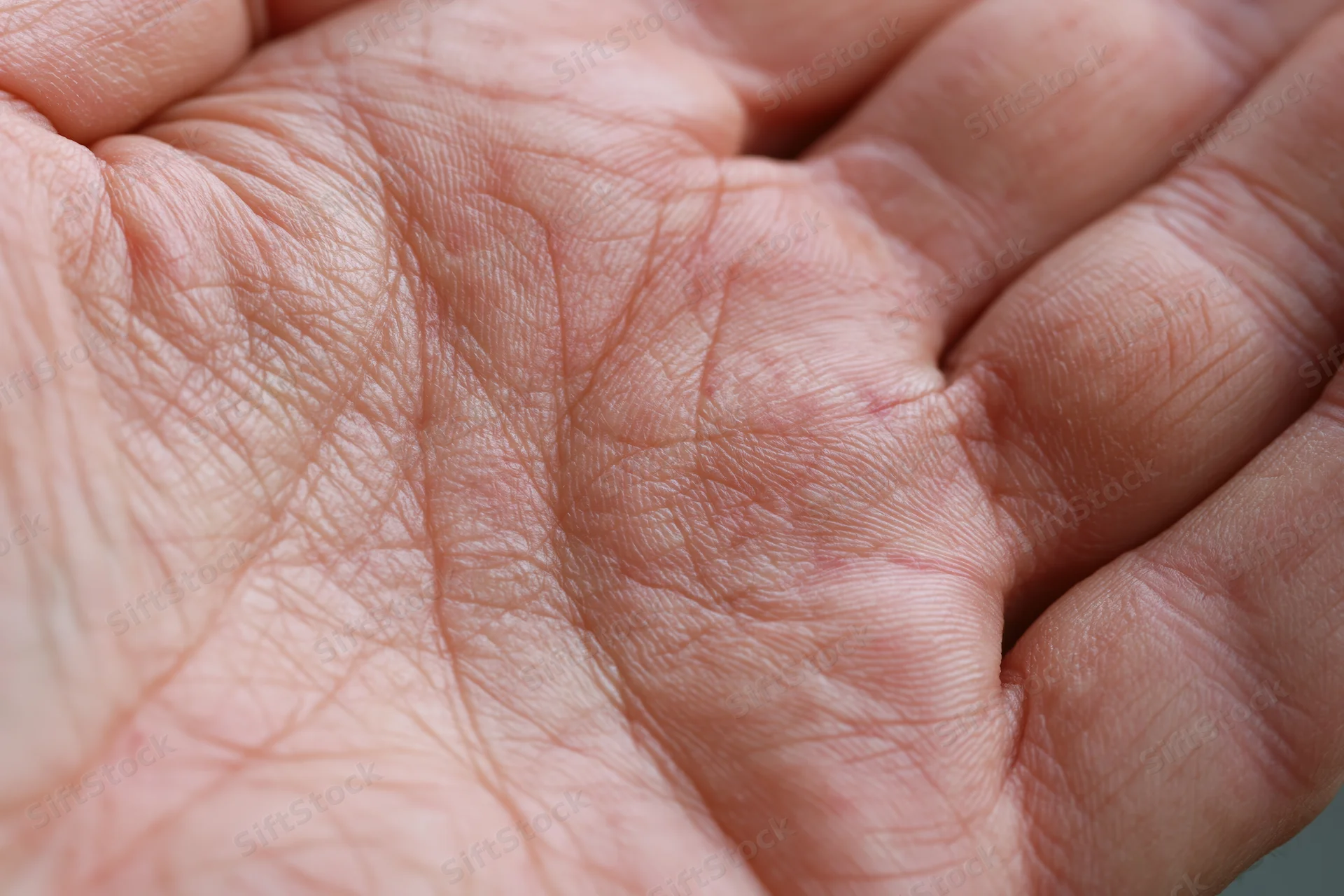 Close-up of an open human palm showing detailed skin texture and wrinkles