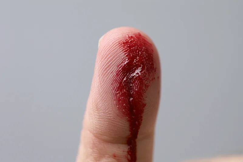 Close-up of a bleeding finger with visible wound and fingerprint against a neutral background