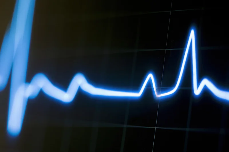 Glowing ecg heartbeat waveform on dark medical monitor screen
