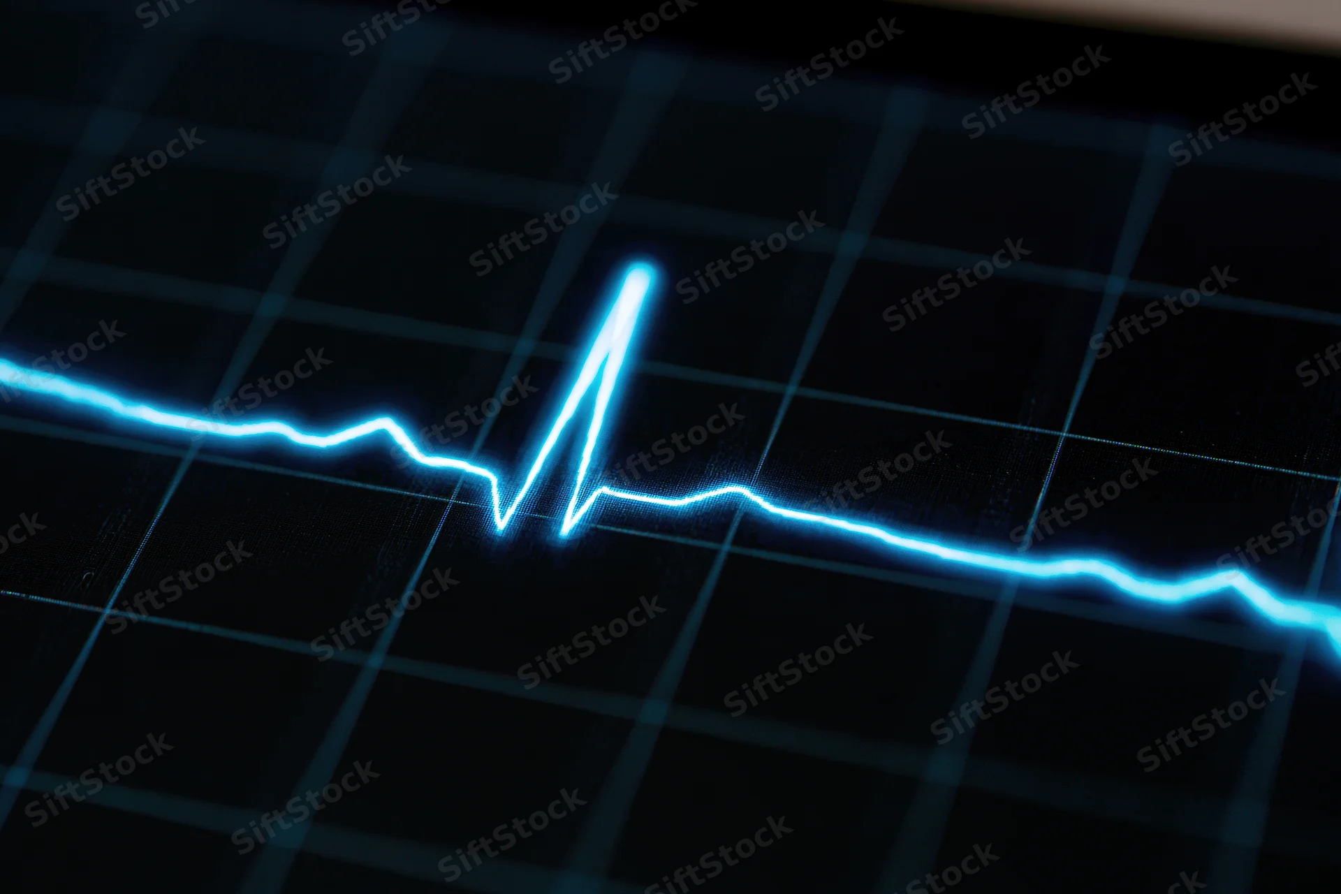 Glowing ecg heartbeat waveform on a dark medical monitor screen