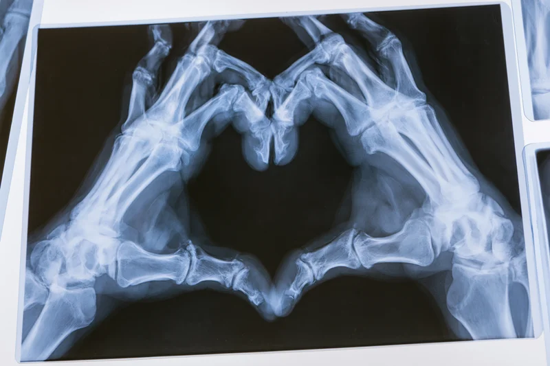 Xray of two hands forming a heart shape with fingers