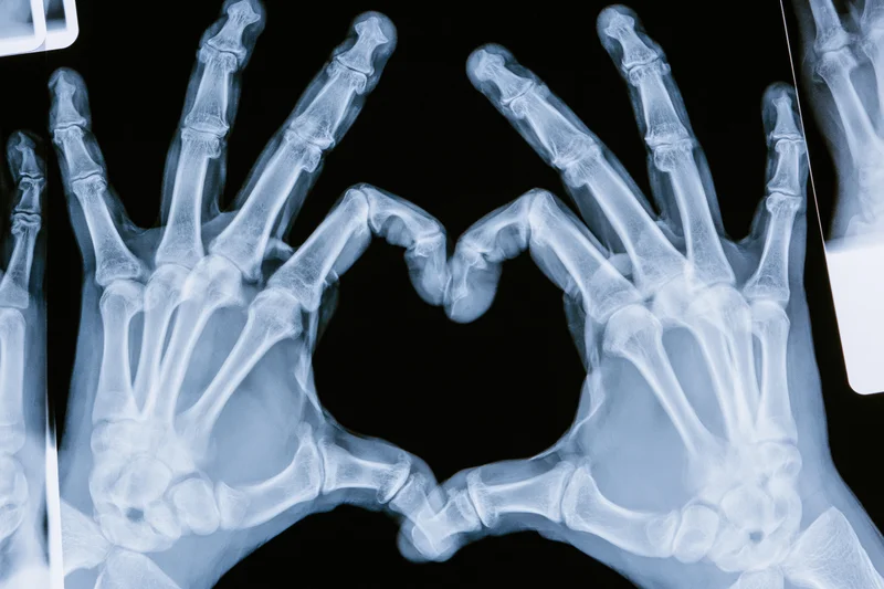 Xray of two hands forming a heart shape with fingers