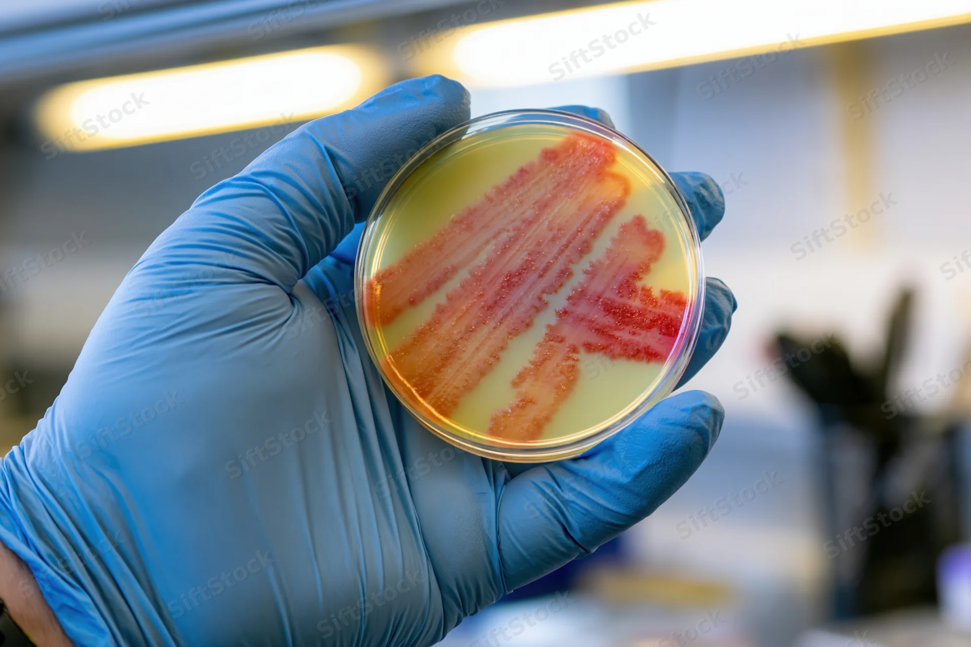 Gloved hand holding petri dish with bacterial colonies in laboratory setting