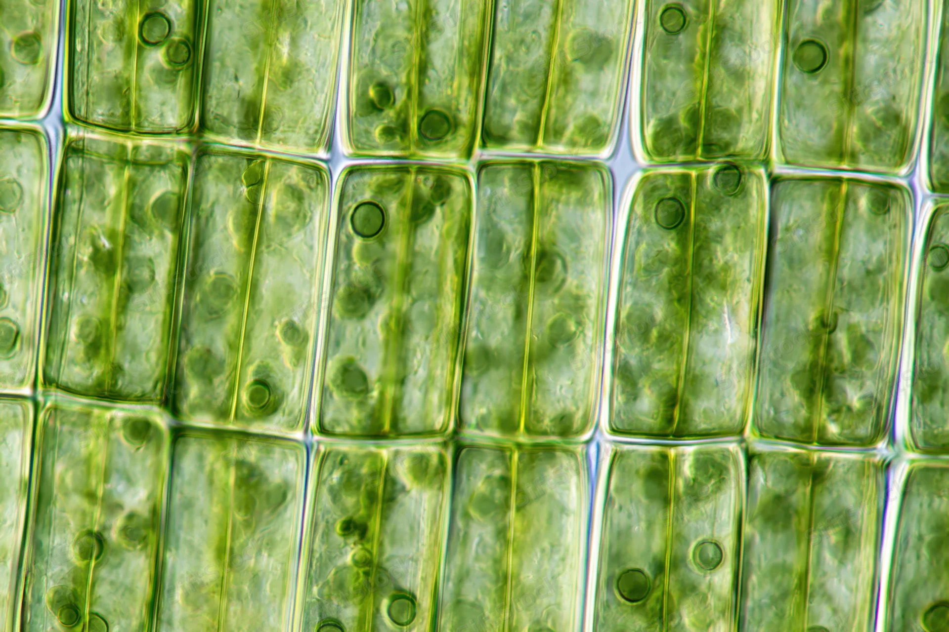 Magnified view of plant leaf cells showing chloroplasts and internal structures under light microscopy