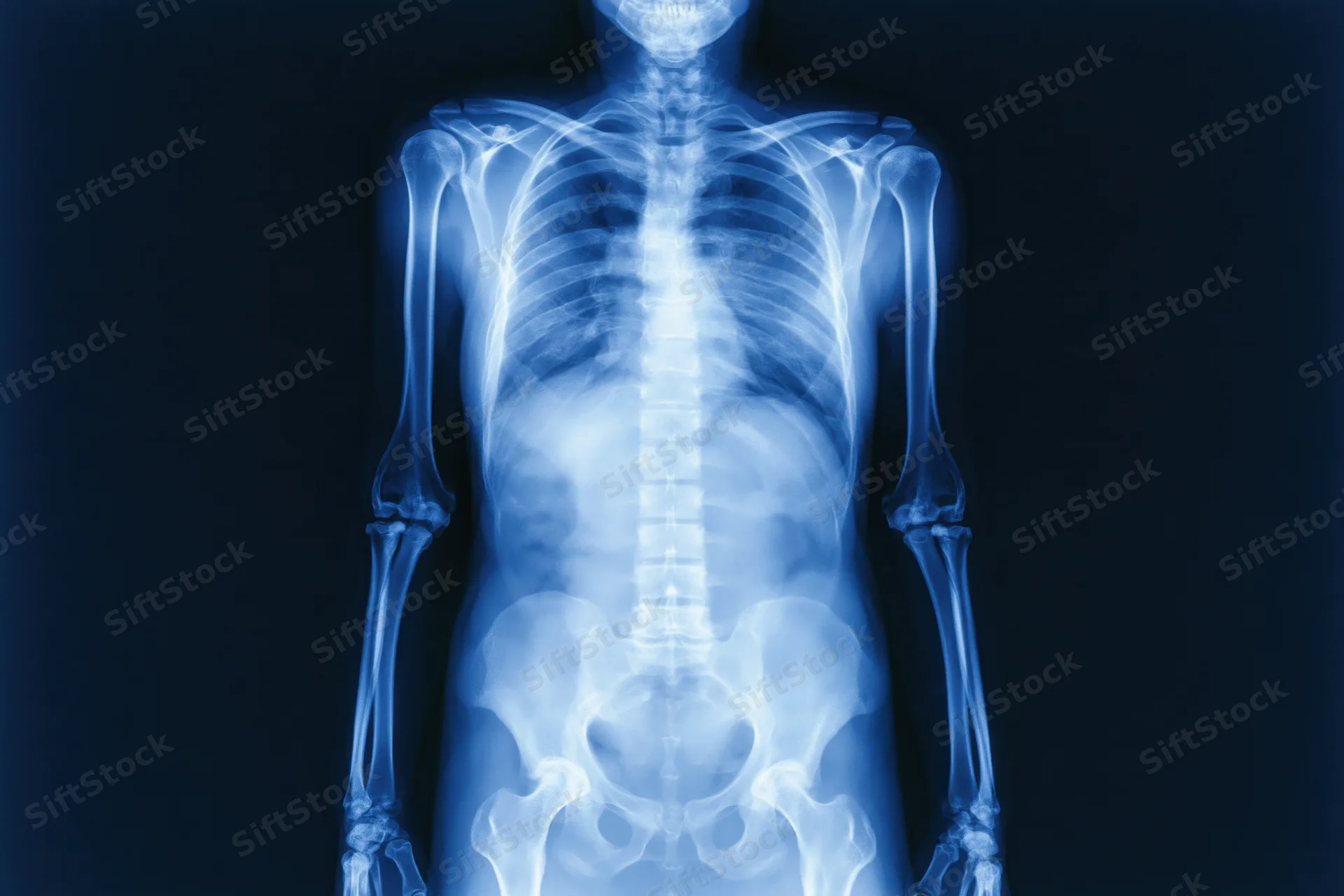Full-body anterior x-ray of human skeleton showing skull to pelvis against dark background