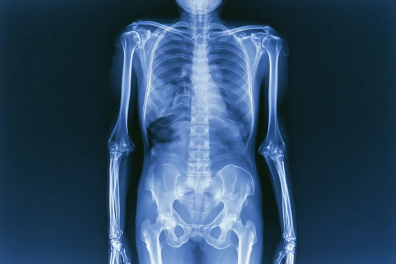 Full-body anterior x-ray of human skeleton showing skull to pelvis