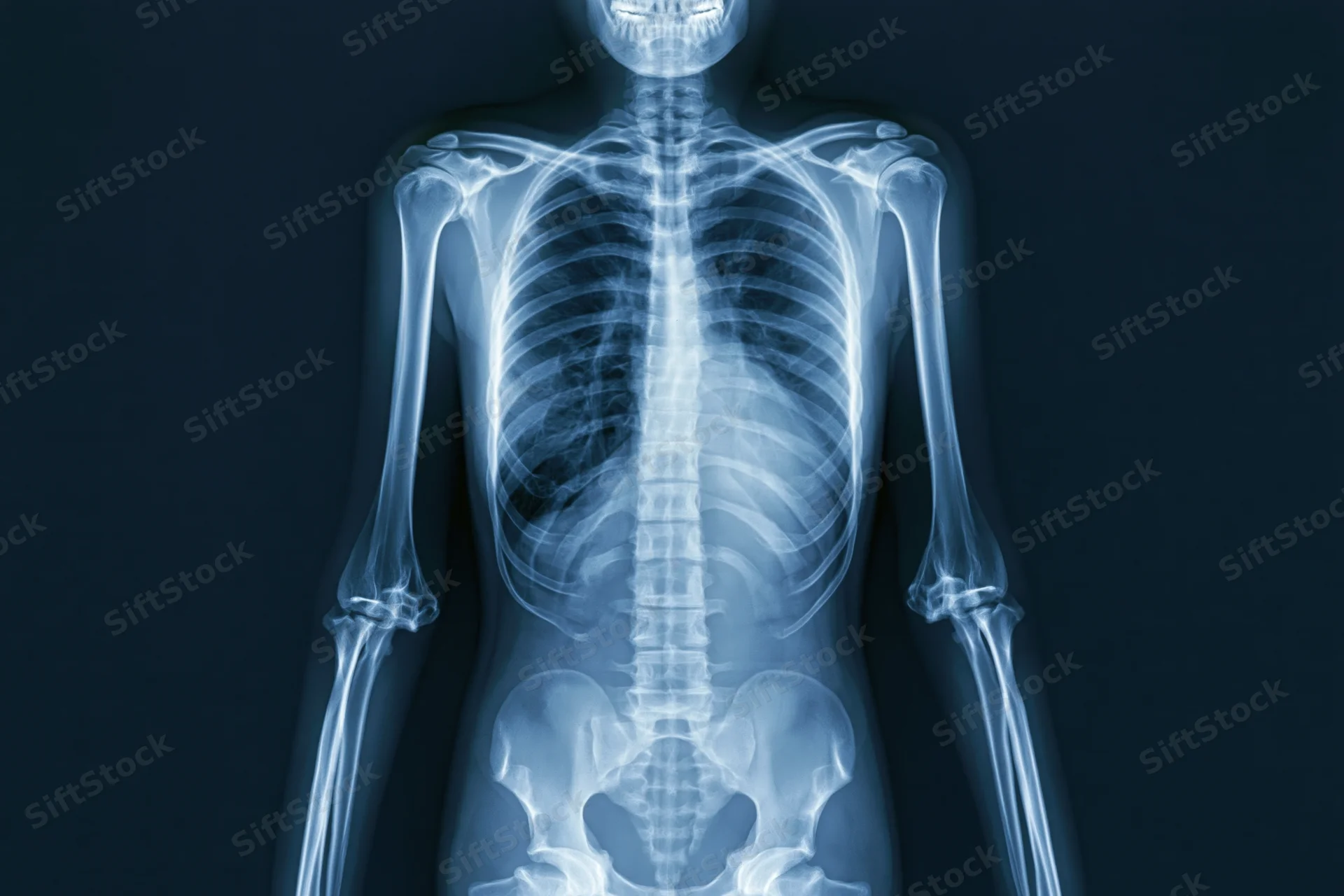 Full-body anterior x-ray of human skeleton showing skull to pelvis