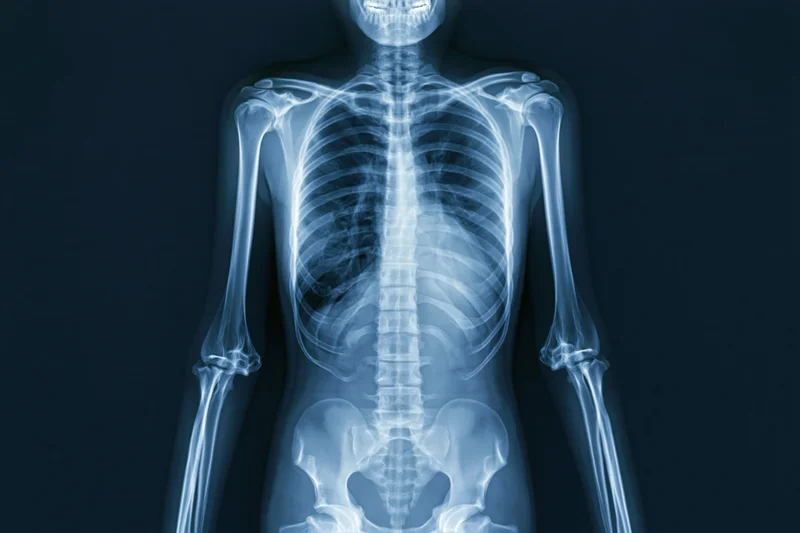 Full-body anterior x-ray of human skeleton showing skull to pelvis