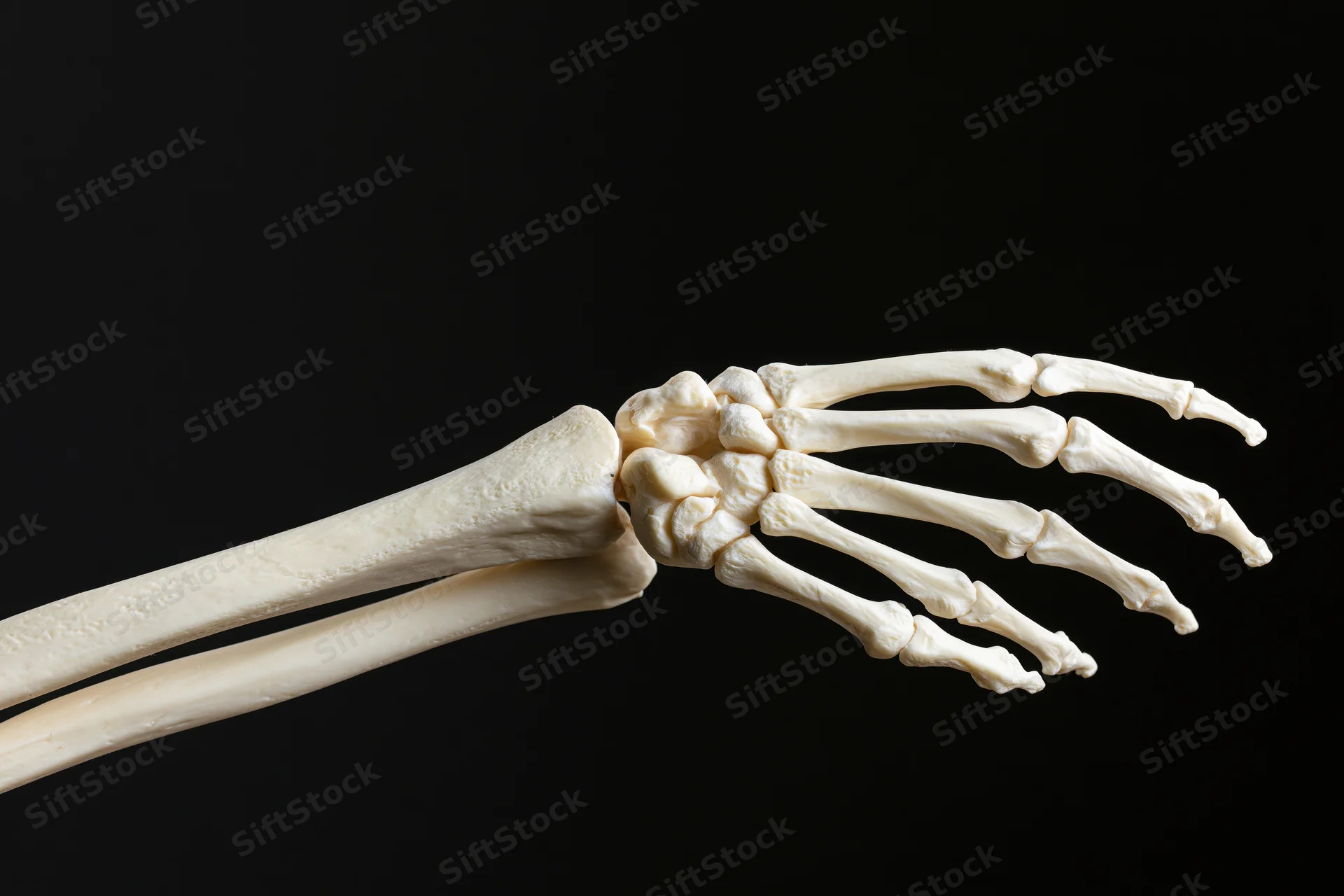 Human forearm and hand skeleton showing radius ulna wrist carpals and phalanges against black background