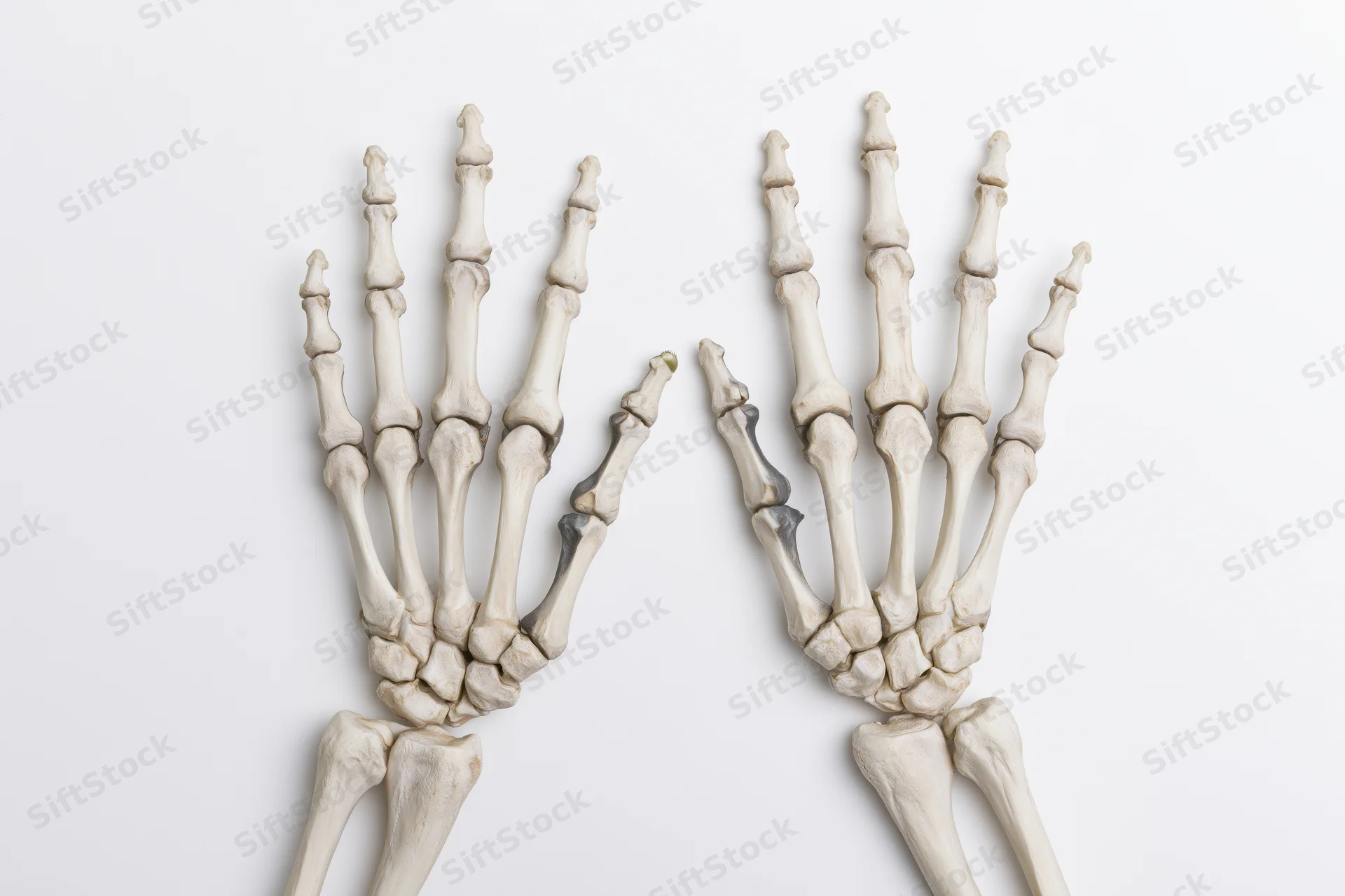 Two human hand skeletons displayed side by side on white background