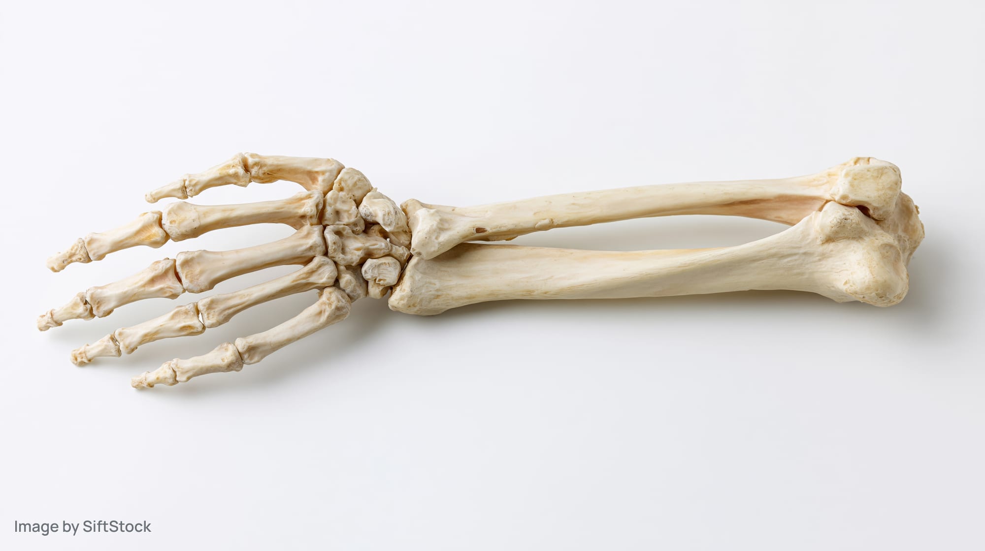 Human forearm and hand skeleton specimen showing radius and ulna bones on white background