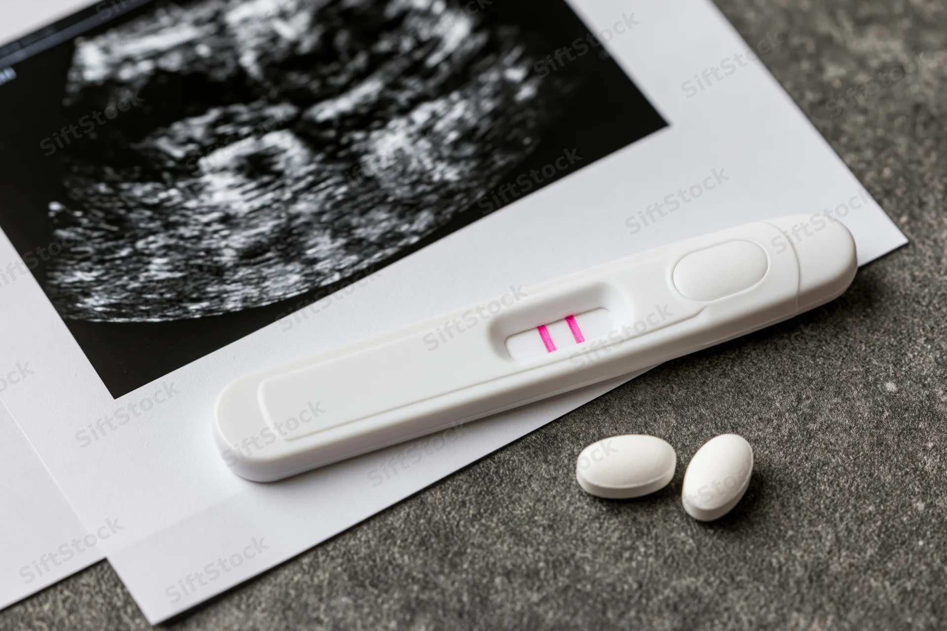Positive pregnancy test with two pink lines resting on ultrasound scan and white pills on gray surface