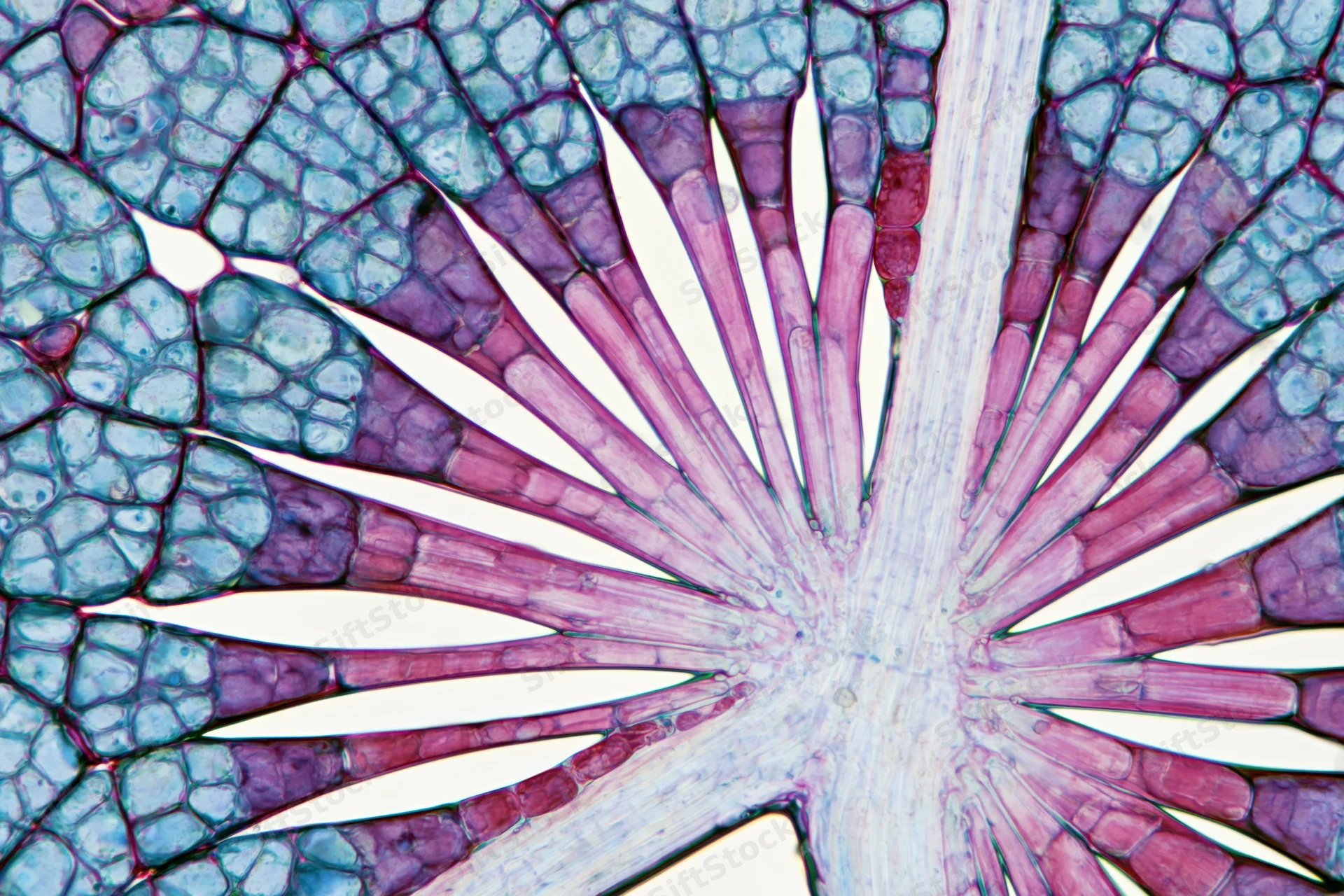 Cross-section of a woody plant stem showing vascular bundles and parenchyma tissue under light microscope
