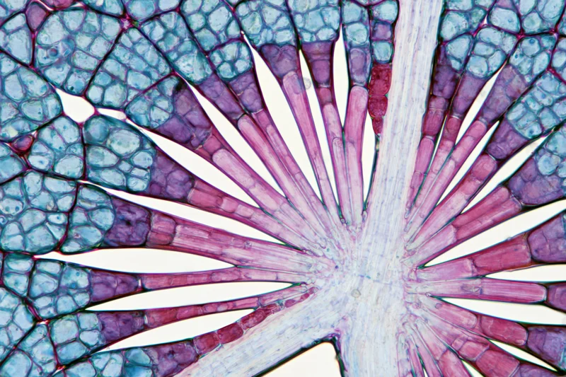 Cross-section of a woody plant stem showing vascular bundles and parenchyma tissue under light microscope