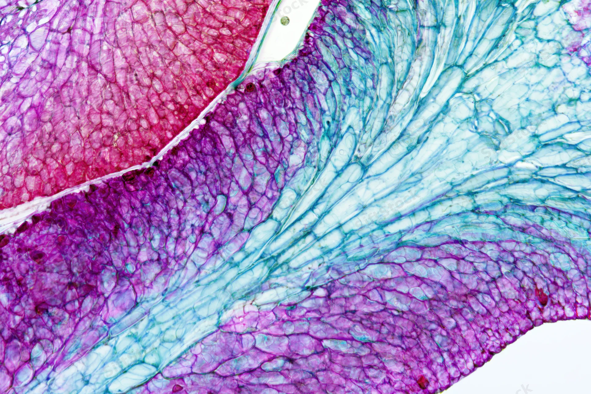 Cross-section of a woody plant stem under light microscope showing stained tissues and cells