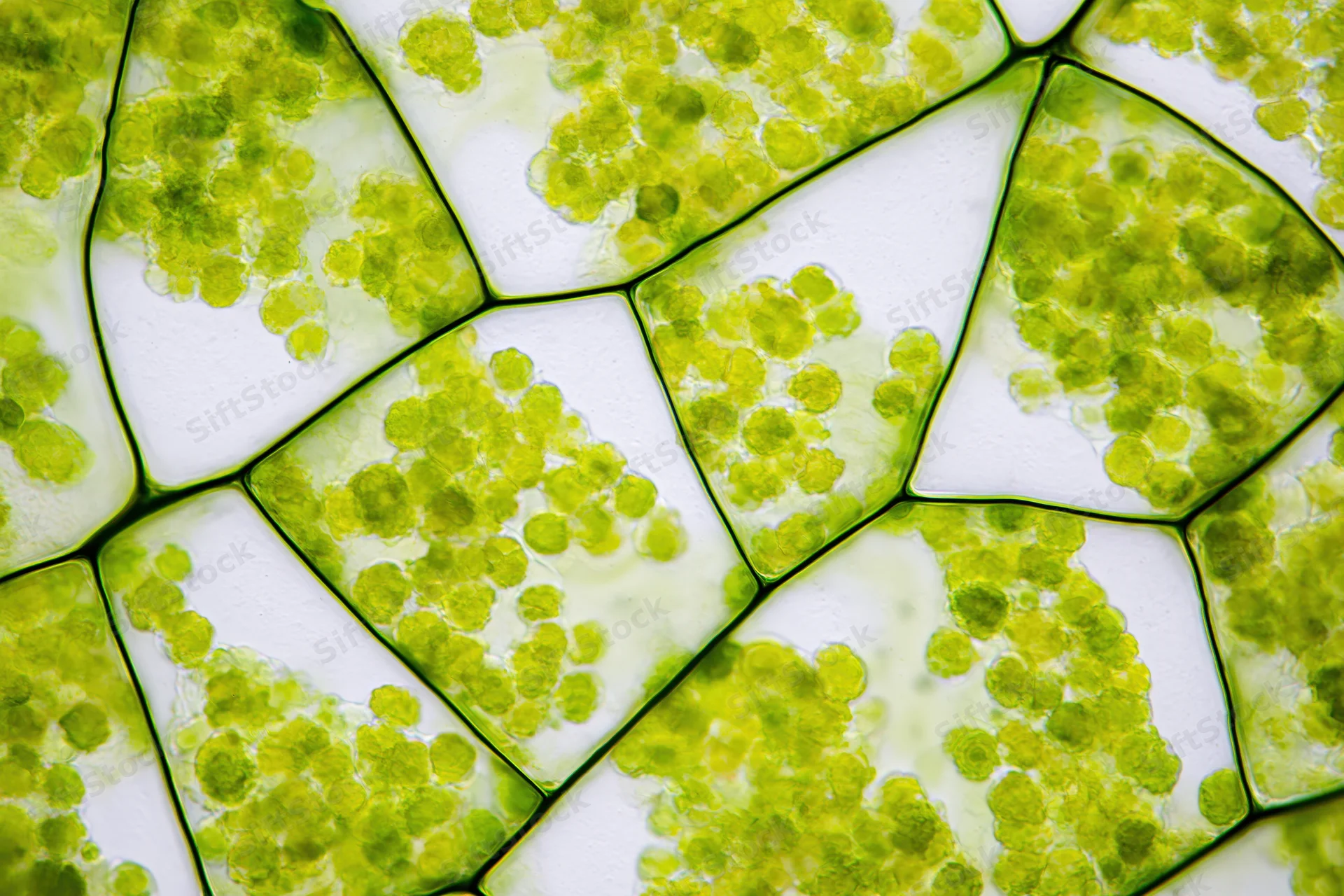 Magnified view of plant cells showing chloroplasts under light microscopy