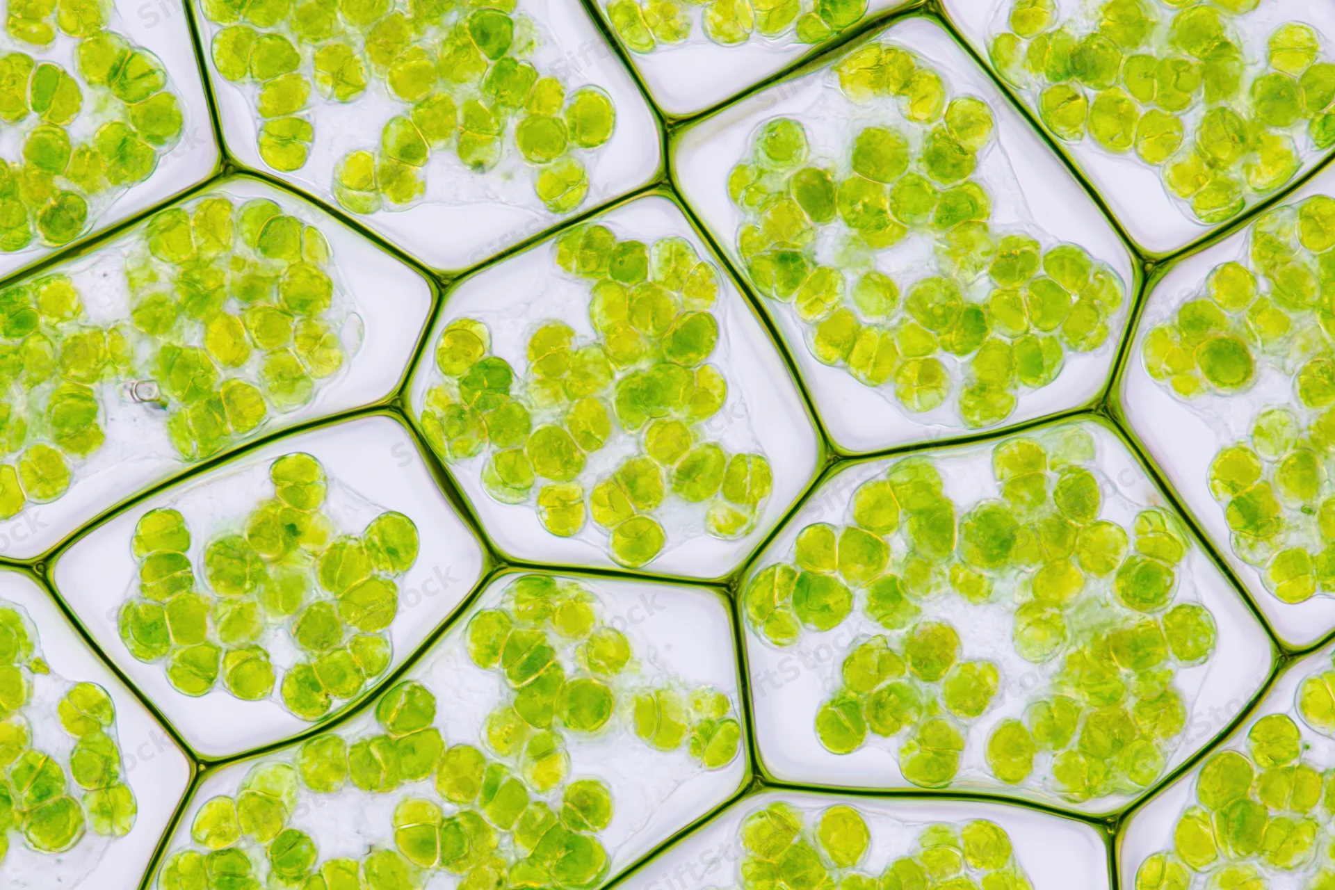 Light microscopy view of plant cells showing chloroplasts within cell walls