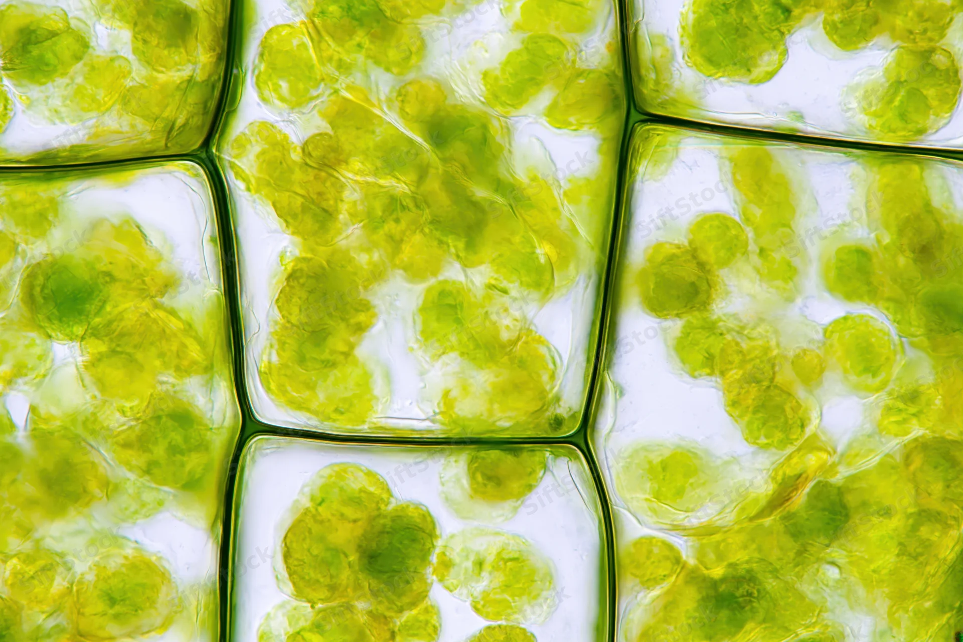Light microscopy view of plant cells showing green chloroplasts within cell walls