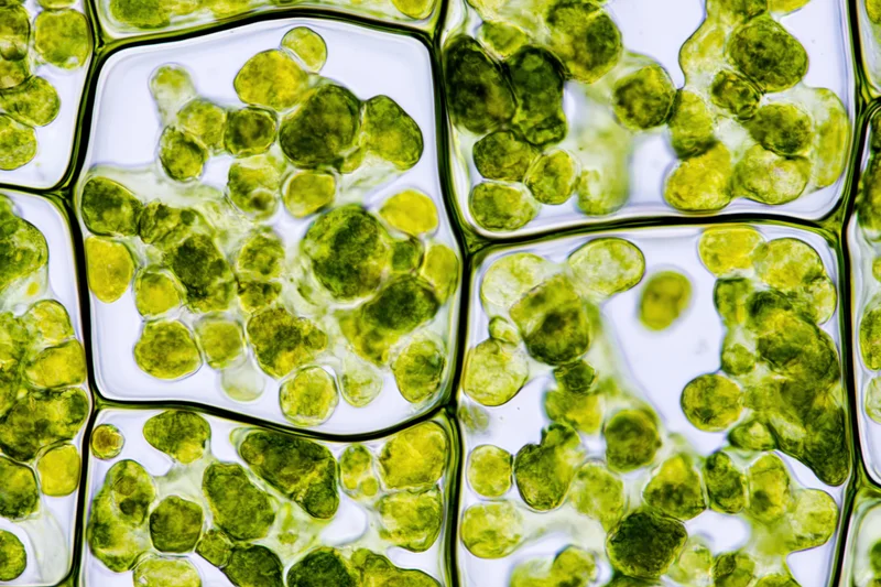Light microscopy view of plant cells showing chloroplasts and cell walls