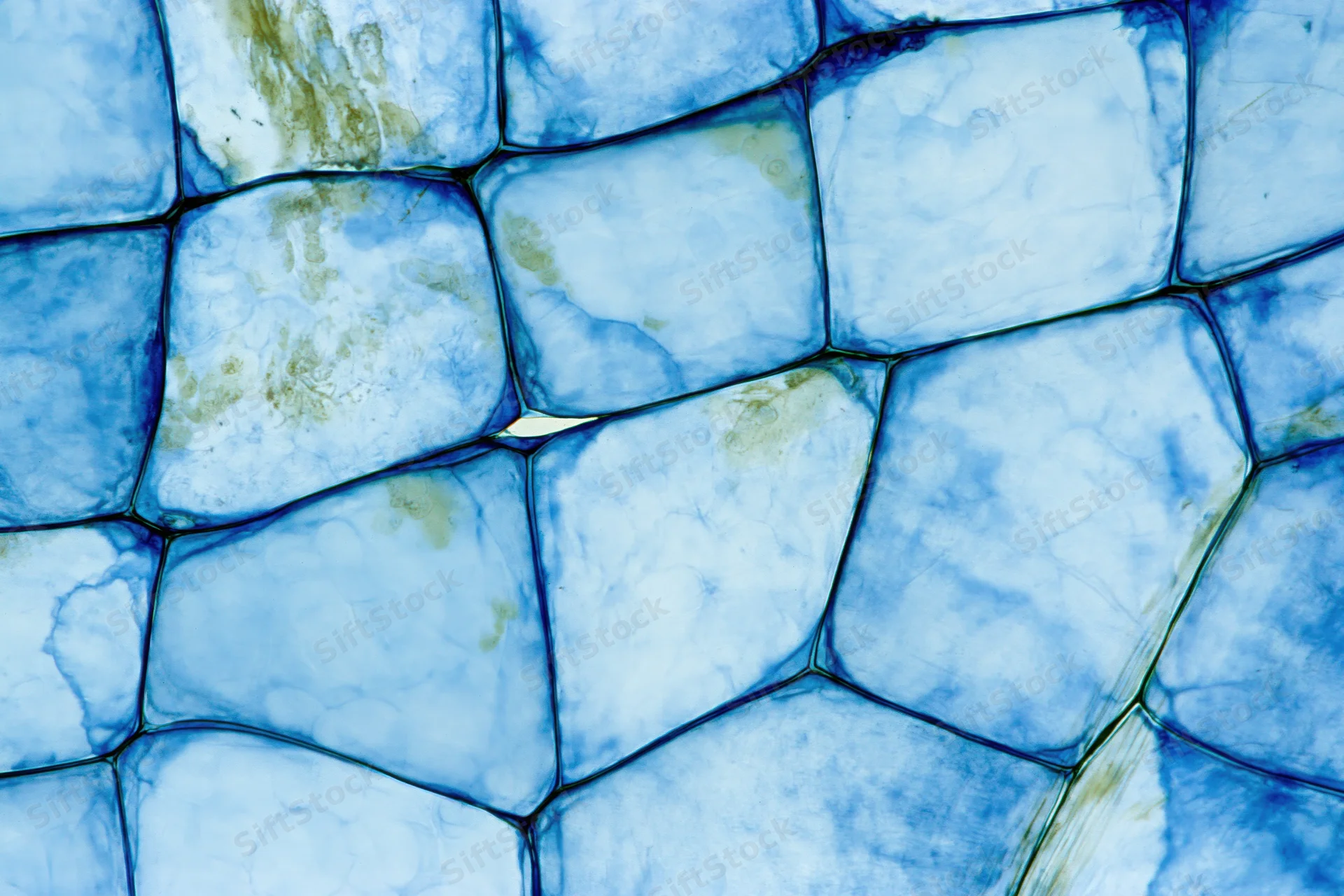 Stained onion epidermal cells under microscope showing cellular structure and blue dye highlights