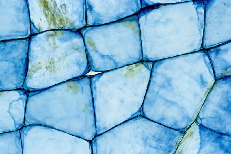 Stained onion epidermal cells under microscope showing cellular structure and blue dye highlights