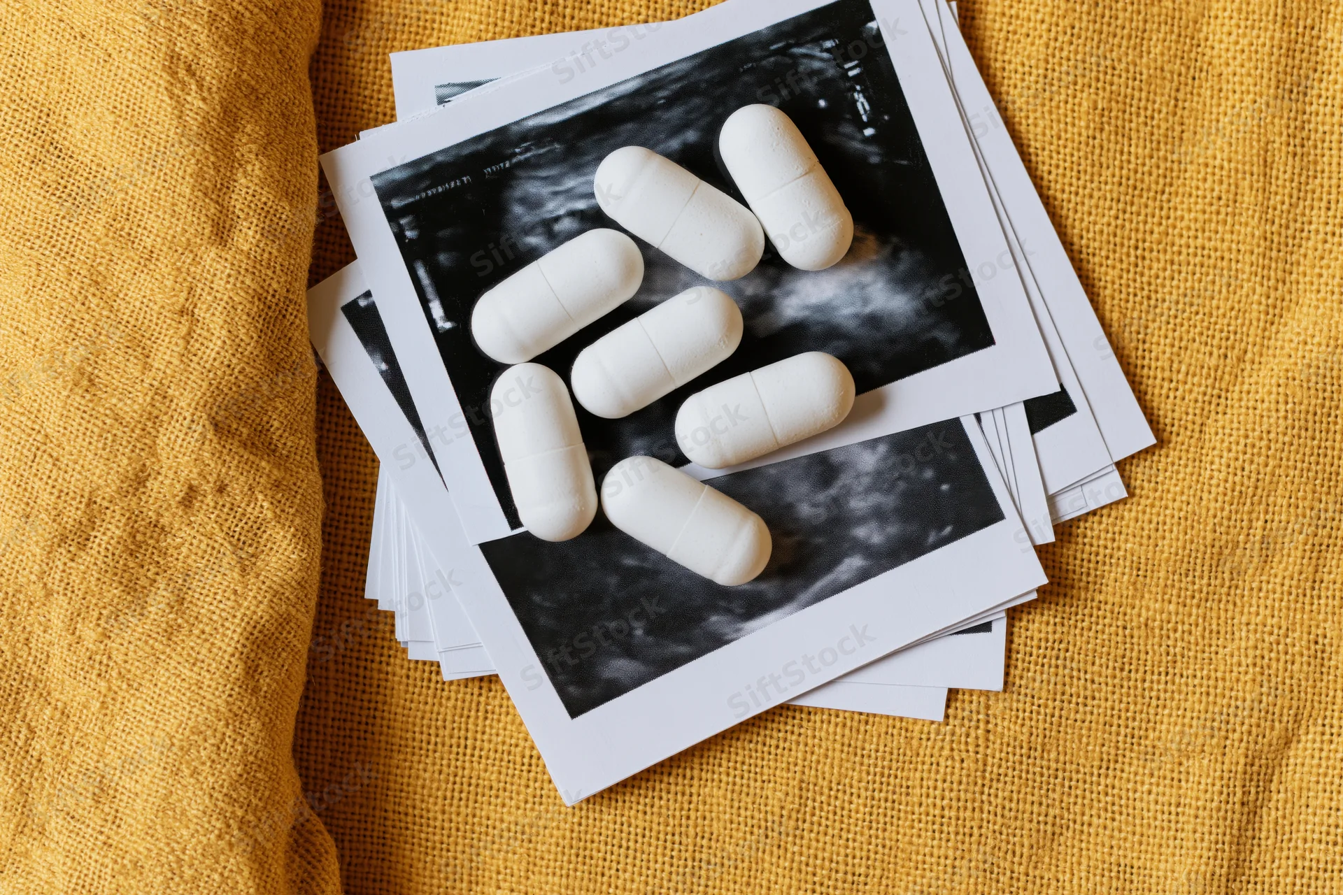 White supplement capsules scattered on top of ultrasound images of pregnancy on a yellow fabric surface