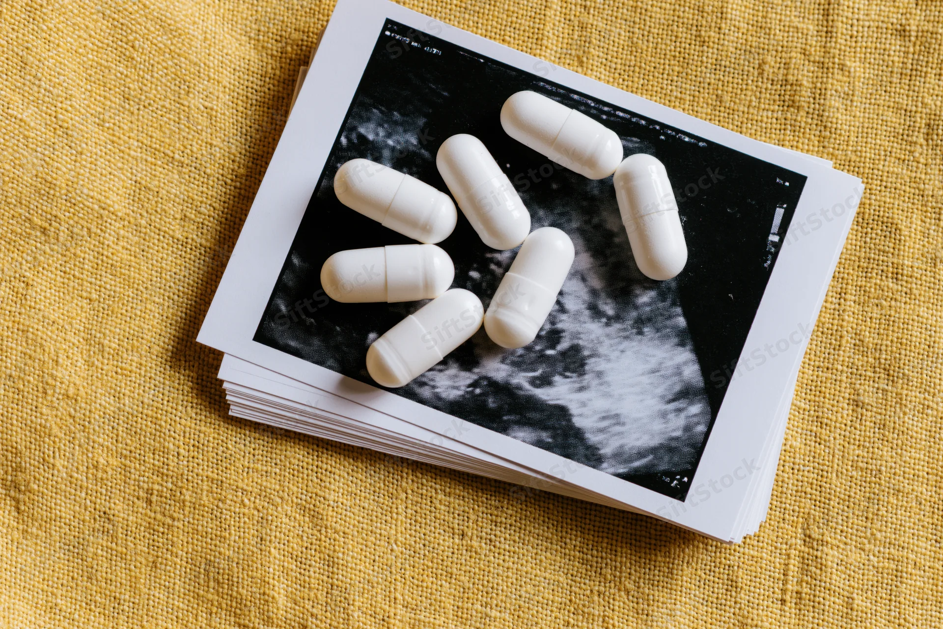 White supplement capsules scattered on top of ultrasound images of pregnancy lying on yellow fabric